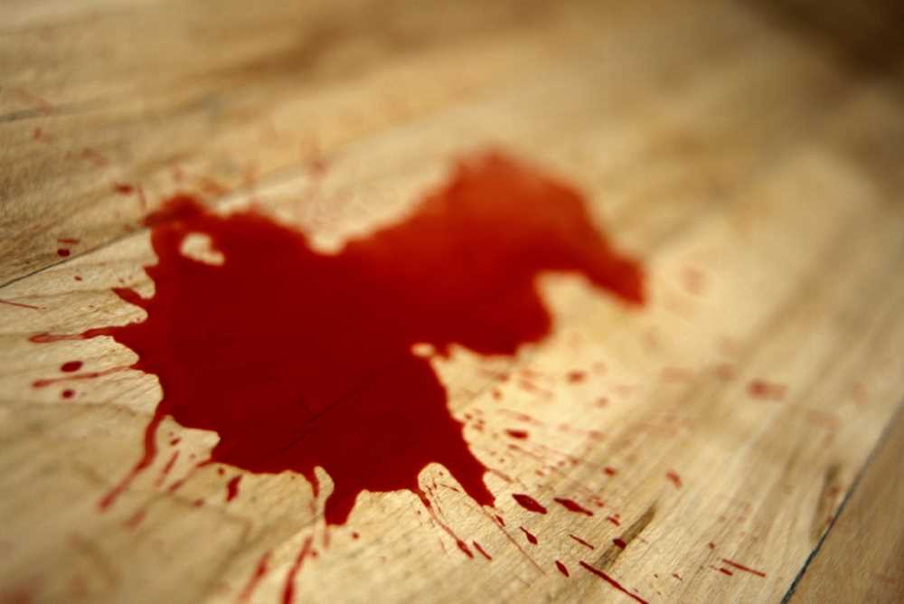 В подъезде дома в Киеве нашли истекающего кровью мужчину (видео)