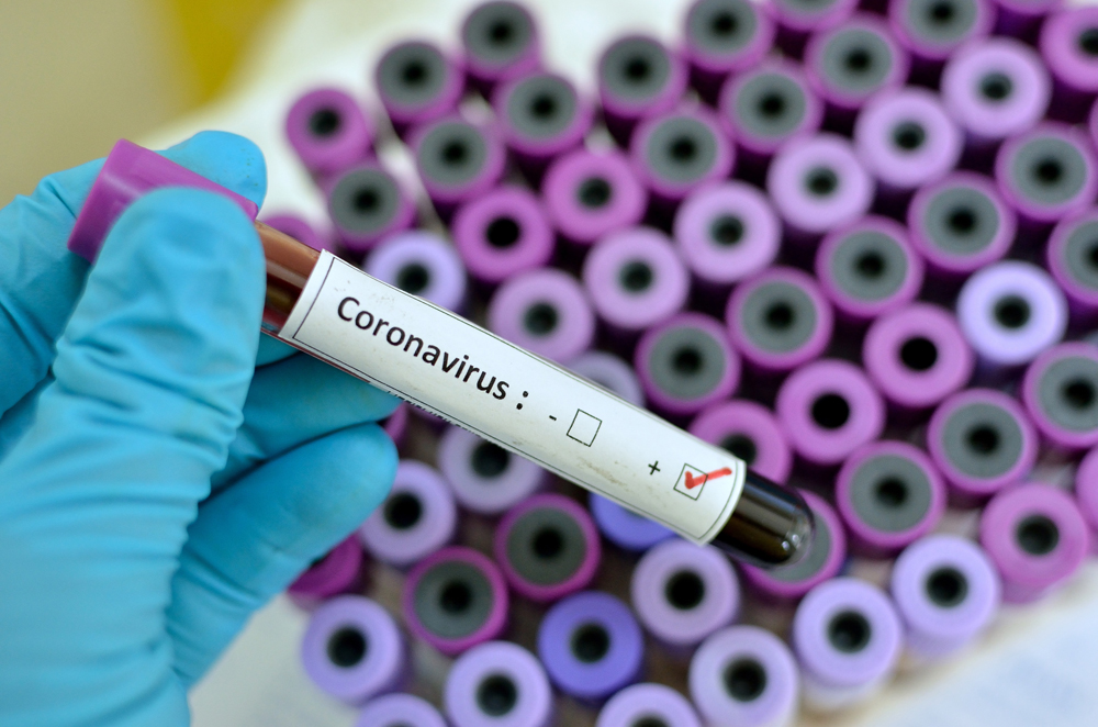 В Киевской области зарегистрировано более пятисот новых случаев заболевания COVID-19