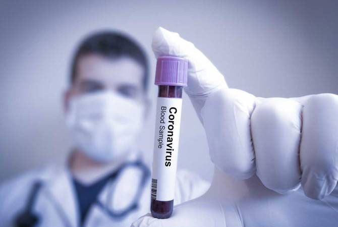 В Киеве более пятисот человек заболели коронавирусом за сутки