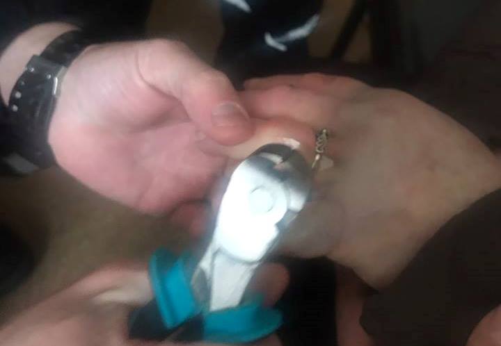 Кольцо с пальца киевлянки снимала бригада спасателей
