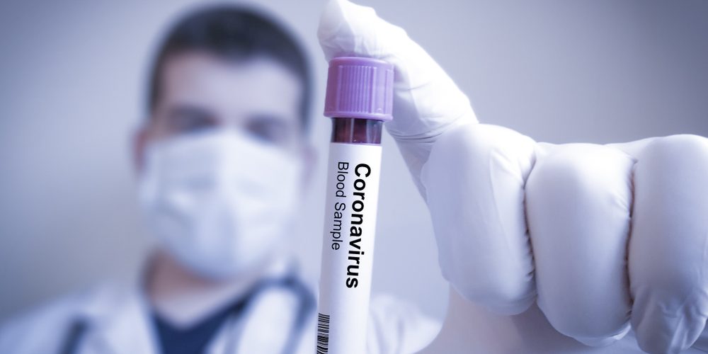 В Киевской области коронавирусом заразилось более двухсот медиков
