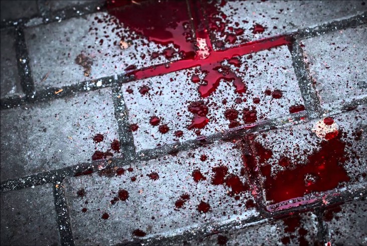 На трассе под Киевом нашли истекающего кровью человека