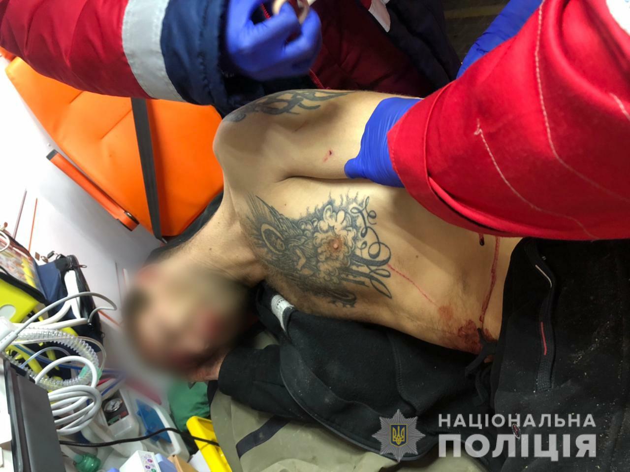 В Софиевской Борщаговке мужчина получил ножевое ранение во время уличной ссоры (видео)