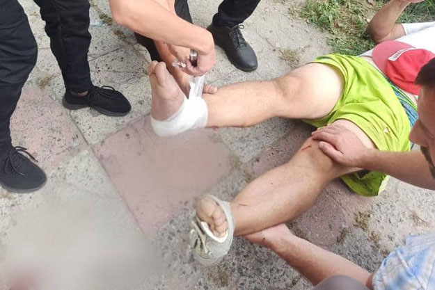 В Бородянке мужчина украшал фасад магазина, упал с высоты и сломал две ноги. На помощь пришли полицейские