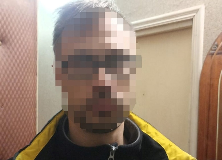 В Киеве мужчина сильно избил знакомого: пострадавший в больнице
