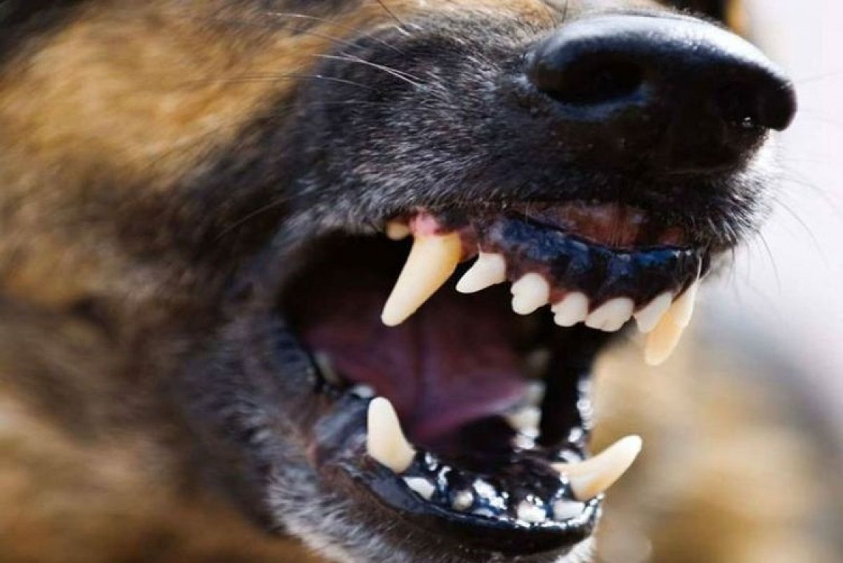 В Киевской области собаки из питомника напали на мать с ребенком