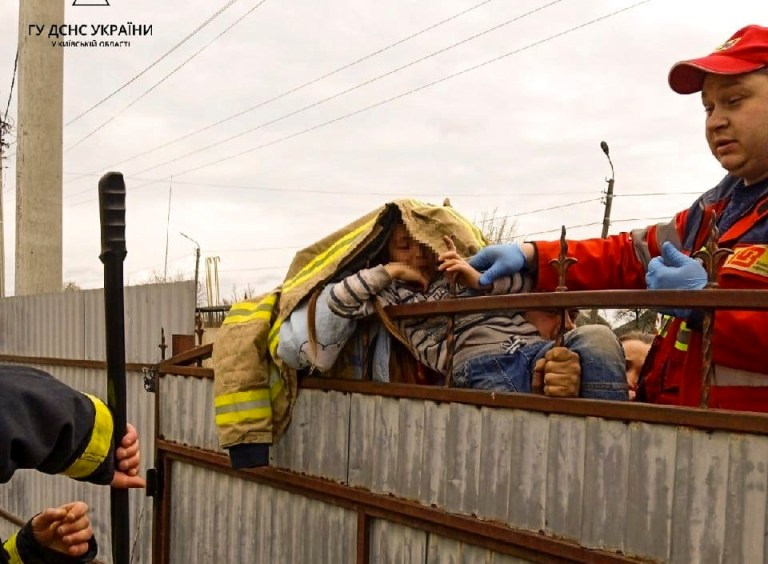 Під Києвом дитина проткнула наскрізь руку, напоровшись на паркан